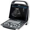 MINDRAY 33962 UMT-150 Carrello per Modello DP-50 Expert e Z5