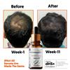 Mount Beauty 2 x siero per la ricrescita dei capelli siero per la crescita dei capelli pro...