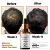 Mount Beauty 2 x siero per la ricrescita dei capelli siero per la crescita dei capelli pro...