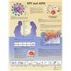 3B Scientific VR1725L Anatomia Umana - Grafico HIV e AIDS, versione Laminata