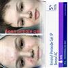 Benzac 4 x BENZAC AC 5% gel perossido di benzoile acne brufolo galderma - 30 g, SPED...