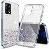 Does not apply Compatibile Con Cover Oppo A74 5G Glitter Trasparente,Custodia Oppo A74 5G Silic