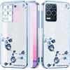 Cover per Realme 8 5G Trasparente Silicone Effetto Glitter, Lusso Brillantini Cu