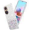 Generic Brillante Custodia per Huawei Nova 9, Glamour Effetto Glitter per Honor 50 Co...