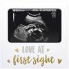 Tiny Ideas Pearhead Tiny Ideas - Cornice portafoto a ultrasuoni con sonogramma Love at First Sight, per neonata o bambino