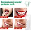 Termico Perline Denti Faccette Modellabile Protesi Dente Provvisorio di