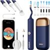 Bebird Pro Otoscopio HD con fotocamera, pulitore orecchie, regolabile, portatile