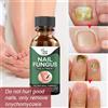 Gel Riparatore Antimicotico Per Unghie Fungine Delle Dita Dei Piedi,