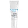 Bionike Aknet Hydra Plus Gel crema idratante 40 ml