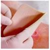 Smith & Nephew srl Allevyn Non Adhesive medicazione non adesiva 20x20cm 3 Pezzi