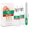 Yoffee Clear XL Kit | Purity Nail | Trattamento naturale Micosi Unghie | Nuovo Formato 120ml |Vitamina E olio Bio di Argan e Tea Tree| Antimicotico Antibatterico | Clinicamente provato|Made in Spain