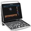 GIMA Color doppler mindray z50 con 2 connettori sonda