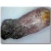 A Bijoux 6,2 Carati Cristallo Tourmaline Rubellite Birmania.
