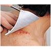 Lohmann & Rauscher Medicazione Tracheostomia Metalline Sterile 8x9cm 50 Pezzi