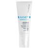 BIONIKE Aknet dermocontrol 40ml