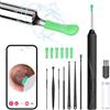 NEOVSUNY Otoscopio, Rimozione di Cerume con Telecamera, 1080P 3,5mm Impermeabile WIFI Endoscopio per Orecchio con 6 Luci LED, Pulisci Orecchie per iPhone, iPad e Android