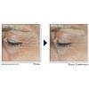 RoC Crema contorno occhi Derm Correxion con Retinolo