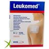 Leukomed Medicazione Post-Operatoria Tessuto non Tessuto 7,2 x 5cm
