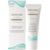 GENERAL TOPICS AKNICARE CREAM TEINTEE CLAIR