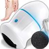 Retoo Levigatrice elettrica per piedi morbidi come setosi, levigatrice per piedi, rimozione calli, dispositivo per la cura dei piedi, Electric Foot File, lima per calli, (bianco 10,5 x 6,5)