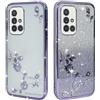 BAOJAY Compatibile per Samsung Galaxy A71 4G Silicone Case [Glitter Bling Cover Glitter Clear View,Custodia Trasparente Antiurto regali per ragazze e signoreo-Viola