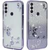 BAOJAY Compatibile per Huawei P30 Lite Silicone Case [Glitter Bling Cover Glitter Clear View,Custodia Trasparente Antiurto regali per ragazze e signoreo-Viola