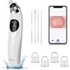 GUPAY Pulitore per i punti neri con fotocamera HD 1080P, aspiratore sottovuoto con 4 testine di aspirazione, 5 potenza di aspirazione per brufoli acne Whitehead per la pulizia della pelle del viso