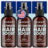 Moerie Spray Crescita Capelli Definitivo Progettato per la Crescita Capelli Veloce Donna e Ricrescita Capelli Uomo, Siero per Capelli 100% Naturale con più di 1000 Minerali, Vitamine e Amminoacidi-x3