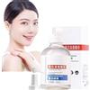 Orgrul Aobenz siero per correggere macchie scure aobenz serum per schiarire e rimuovere lentiggini siero smacchiatore per viso (1 pezzo)