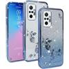 Jeelar Cover per Xiaomi Redmi Note 10 Pro 4G, Custodia Protettiva Simpatica Custodia Protettiva Glitterata per donne e Ragazze Custodia Blu