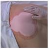 Medicazione Idrocellulare Adesiva Sterile Conformata Per La Regione Sacrale Assorbente In Schiuma Di Poliuretano Allevyn Sacrum 22,5x22,1cm 10pezzi