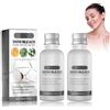 Beslibate Crema Schiarente Per La Pelle, Crema sbiancante per il corpo, Crema Sbiancante, Efficace per Ascelle, Ginocchia, Gomiti, Bianchi, Nutre, Ripara E Ristruttura La Pelle 2Pc whiteningcream-4