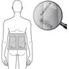 Mesis Magnetowaves - Diffusore tessile Alta frequenza Lombare/Renale 10 Kg