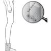 Mesis Magnetowaves - Diffusore tessile Alta frequenza Cavigliera 10 Kg