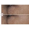 Perricone MD Cold Plasma Plus+ Crema viso (59ml) e occhi (15ml)