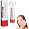 Cynamus Pigment Spot Cream, Anti Pimple Cream Anti-Acne Anti-Pigmentation Cream Brightening Freckle Cream For Freckles Acne Freckle Removal Cream, Whitening Freckles Freckles Cream For Dark Spot Remover, Acne