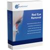 SoftOrbits Red Eye Removal