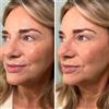 Doll10 Doll Skin Cipria correttiva in polvere (6g) con pennello