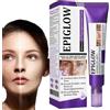 Generico Epiglow Melanex Advanced Anti Hyperpigmentation Cream, 20g Rema Per Le Macchie Scure, Crema Viso Per Trattamenti Di Iperpigmentazione, Crema Idratante Non Grassa Per Tutti I Tipi Di Pelle