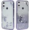 BAOJAY Compatibile per Samsung Galaxy A20E Silicone Case [Glitter Bling Cover Glitter Clear View,Custodia Trasparente Antiurto regali per ragazze e signoreo-Viola