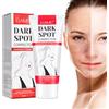 Utapossin Anti Macchie Viso Crema, Crema Schiarente Macchie Viso, Dark Spot Corrector Remover, Utilizzato per Tono Della Pelle Irregolare, Rimozione Macchie Scure, Anti-melanina, Sbiancante e Schiarente-50ml