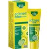 ESI SpA ESI ACKNES GEL ACTIVE 25 ML