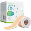 NUEDSFXO Cerotti Silicone Cicatrici, Cerotto a Nastro, Crema Cicatrici Chirurgiche, Fogli per Cicatrici in Silicone per Acne, Cheloidi, Ustioni, Smagliature, Cicatrici Da Taglio Cesareo (4X 150 cm)