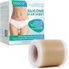 NVXNMSD Cerotti silicone cicatrici silicone scar sheets 150cm X 4cm fogli extra lunghi per cicatrici con taglio cesareo, addome, cheloidi e cicatrici chirurgiche, riutilizzabile in silicone di