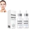 Wootapson Crema per la rimozione delle macchie scure,Crema Smacchiatore per Macchie Scure,Anti Macchie Viso Crema,Anti-melanina Idratante e ringiovanente per il viso Uguale Tonalità Della Pelle