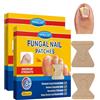MYMULIKE Fungal Nail Patches, 56 Pansements Micosi Unghie Piede Forte, 8Ore Cerotti Funghi Unghie Piedi, Rapida ed Efficace Antimicotico, Riparare Danneggiate e l'aspetto Delle Unghie Scolorite