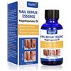 Toulifly Trattamento Antimicotico, Micosi Unghie Piedi, Cura Funghi, Soluzione Per La Cura Delle Unghie, Fungo Unghie Piedi, Tratta Funghi, Rinforza Unghie, 30ml