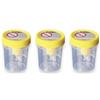 Corman SpA Contenitore Urina Sterile Medipresteril Con Sistema Transfert Per Provette Sottovuoto Set da 3 3x1 pz Sapone