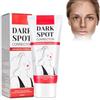 Boxiatil Crema Sbiancante 60ml, Crema idratante viso, Sbianca il Viso e Illumina L'incarnato, per un'idratazione intensa Antietà e Antimacchia Antietà, Adatta a Tutti i Tipi di Pelle02