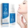 Ekukeon Acnespray, Acido ipocloroso, Spray per la cura del viso, Spray tonico per il viso Skin Renewer | Per una pelle pulita e sana, adatto all'uso quotidiano (30 ml)